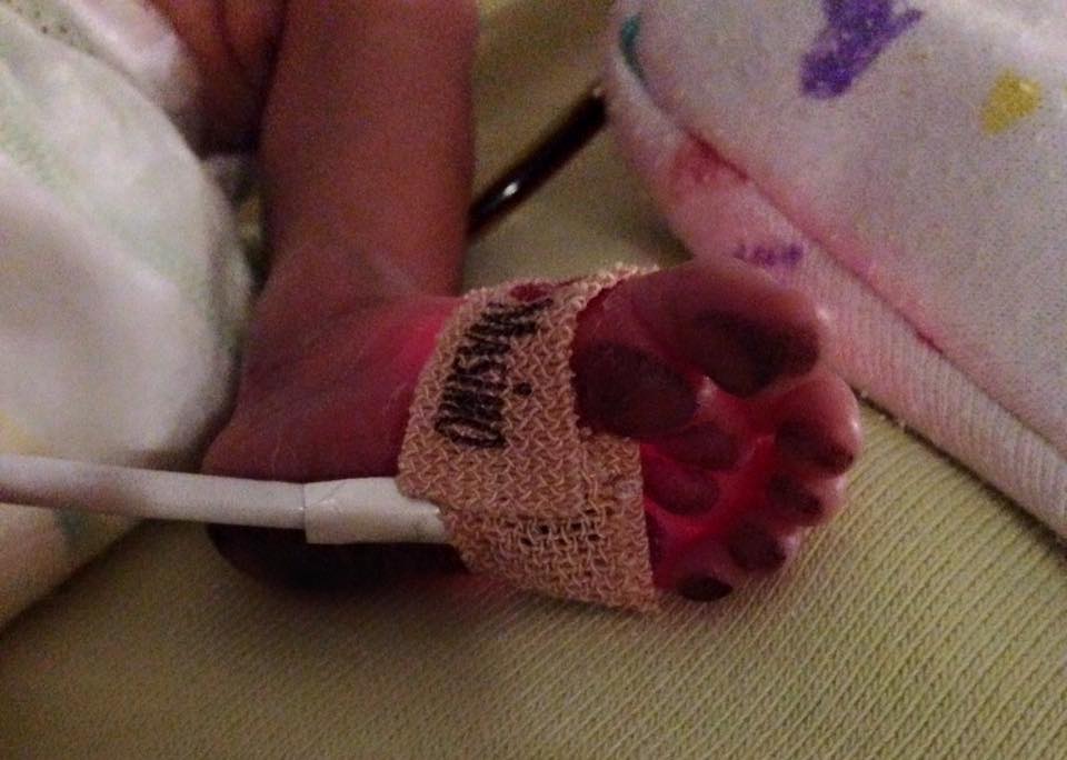 A baby 's hand wrapped in bandage holding an electrical cord.
