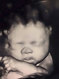 A baby is holding its head in her arms.